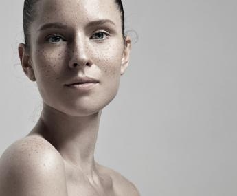 Fractional Laser Venus Viva